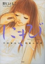 にきび (1巻 全巻)